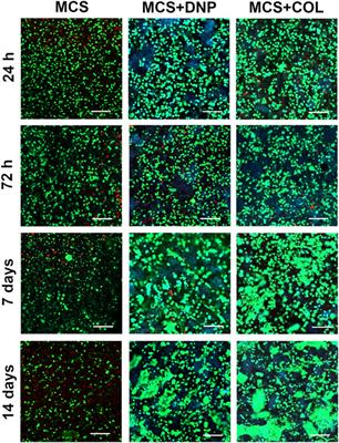 Development of 2-D and 3-D culture platforms derived from decellularized nucleus pulposus